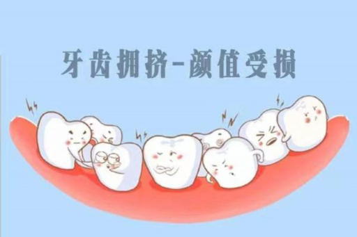 美国AO自锁托槽（ormco自锁托槽是哪个国家的）(图1)